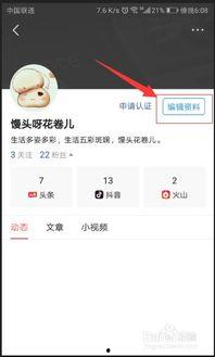 头条可以改变名字吗吗,用户可自主更改昵称，打造个性化网络身份
