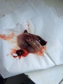 吃小瓜会掉内膜吗,吃小瓜与内膜脱落的关系